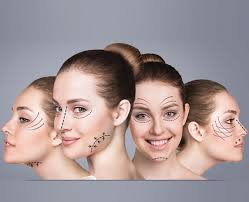 FACELIFT